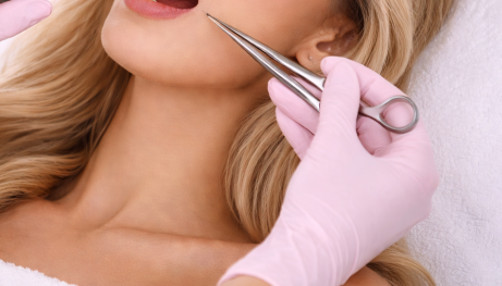 Procedimento De Bichectomia